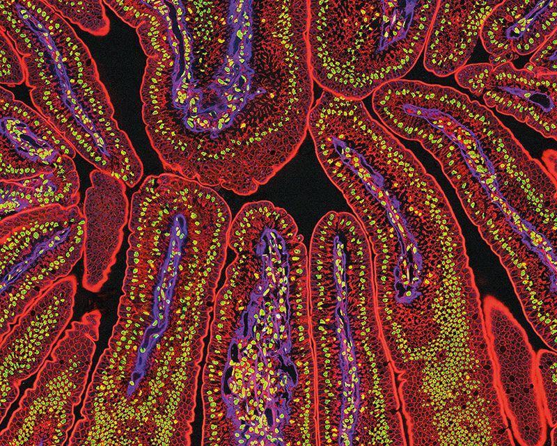 Focus des études sur le microbiote intestinal !